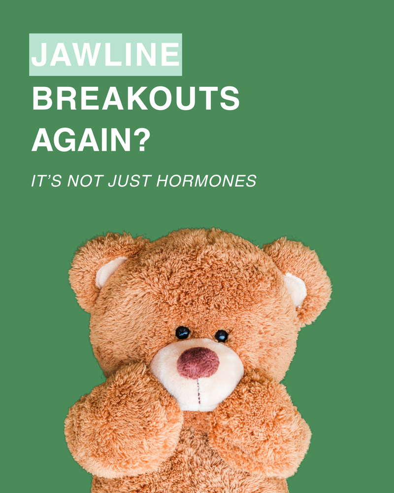 Jawline Breakouts Again? It Is Not Just Hormones
