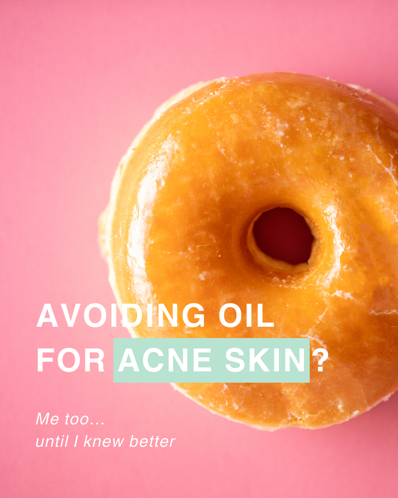 Avoiding Oil for Acne Skin?