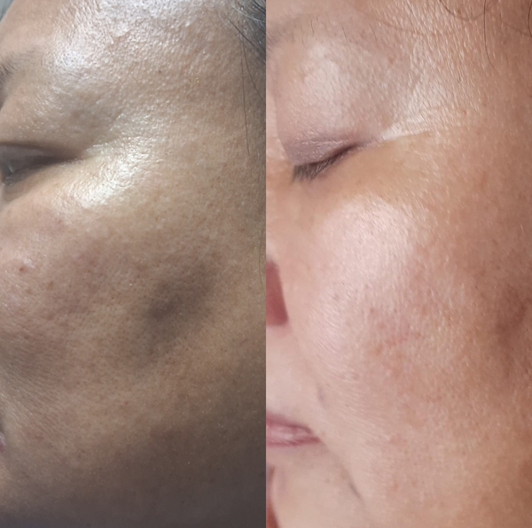 Khrienuo, 50
