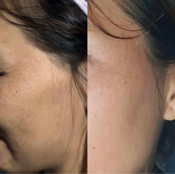 Ali, 39