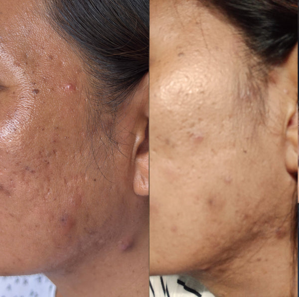 Limei, 35